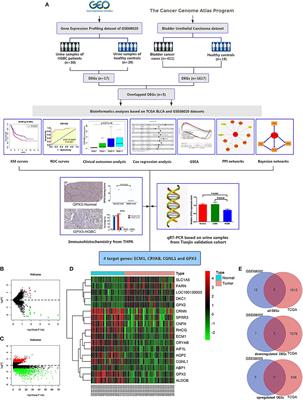 Gene Expression Profiles Identified Novel Urine Biomarkers for Diagnosis and Prognosis of High-Grade Bladder Urothelial Carcinoma